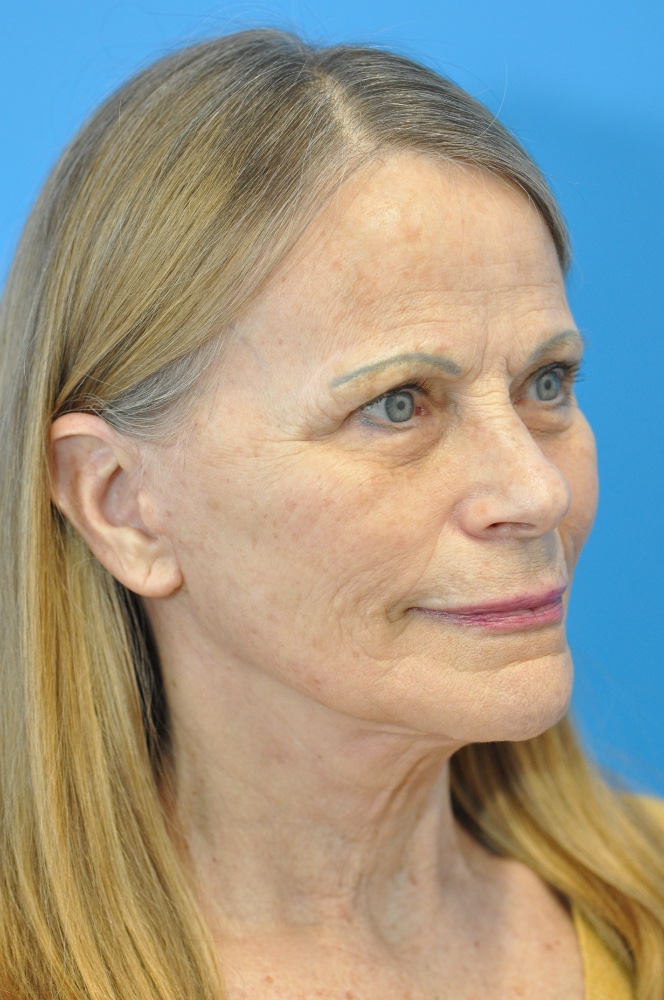 after image