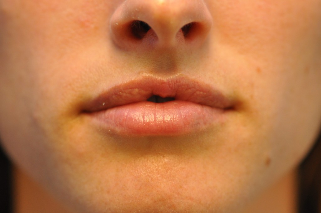 before image