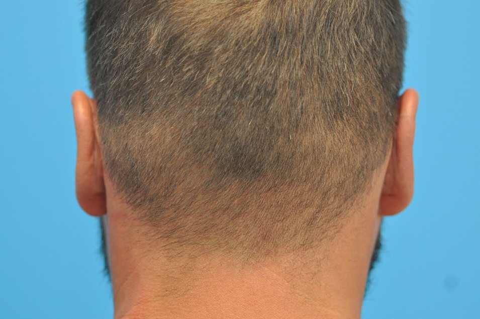 after image