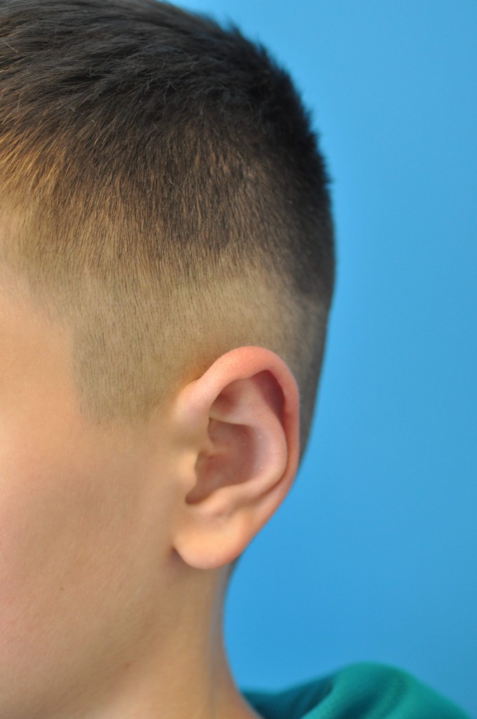 after image