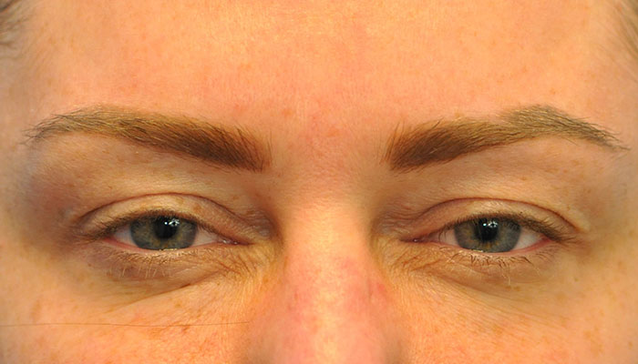 after image