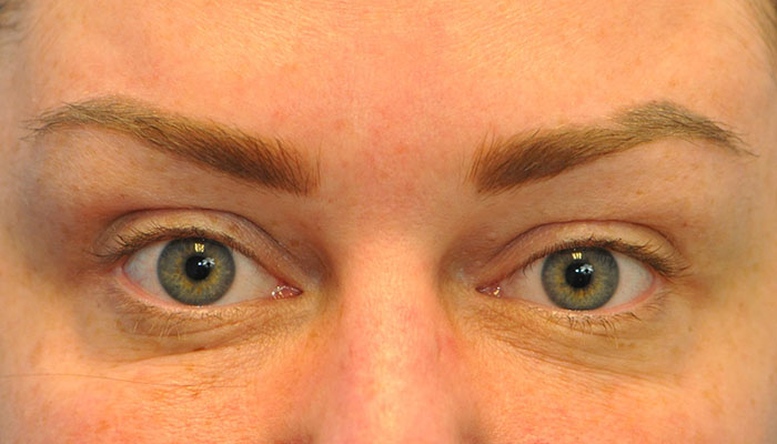 after image