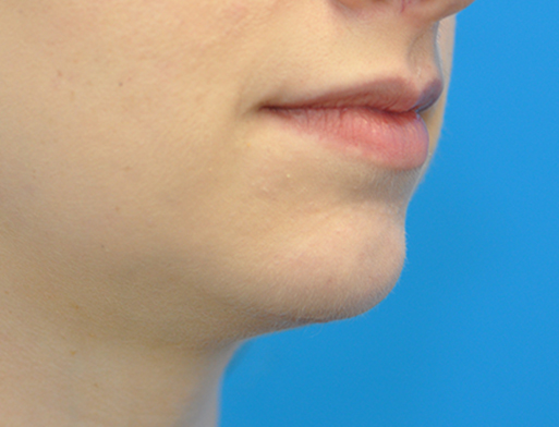 after image