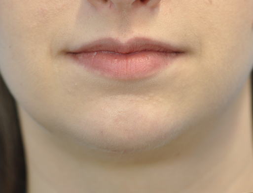 after image