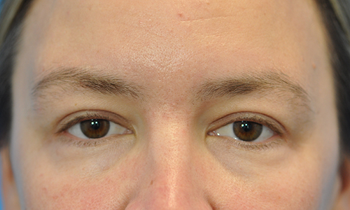 after image