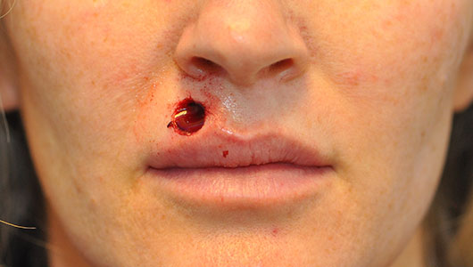 before image