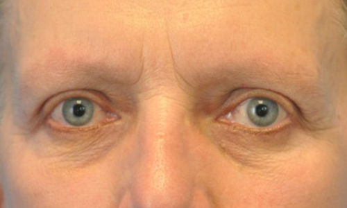 after image
