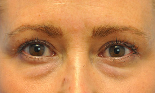 after image
