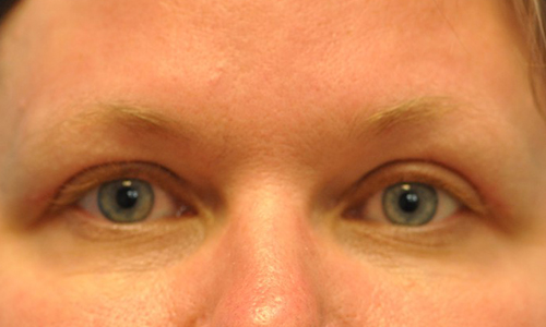 after image