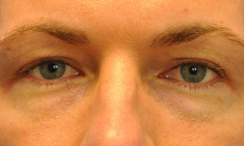 after image