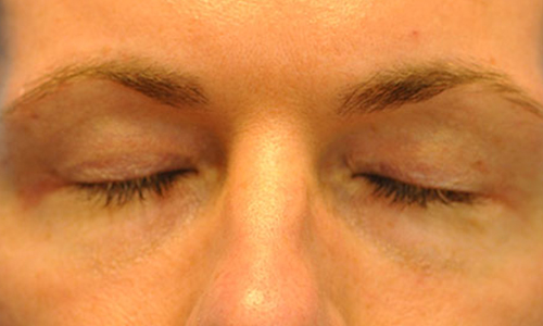 after image