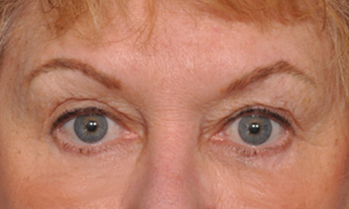 after image