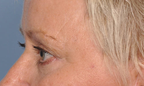 after image