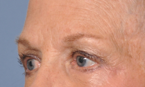 after image