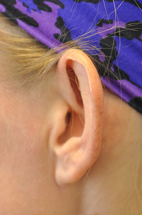 before image
