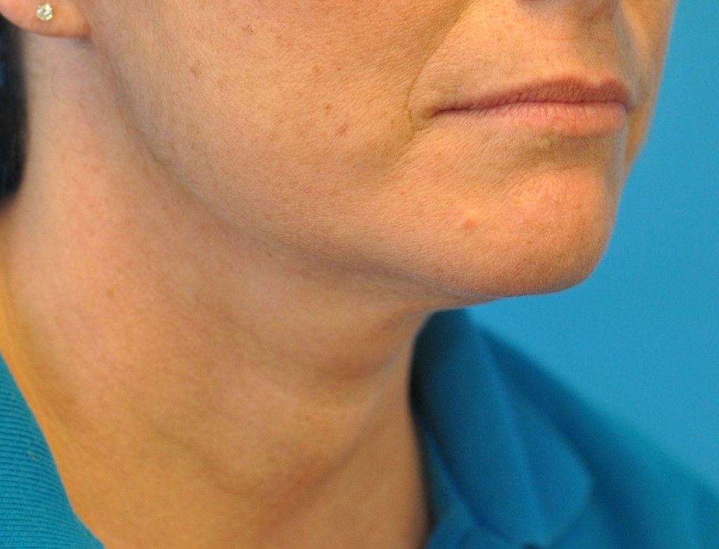 after image