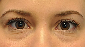 after image