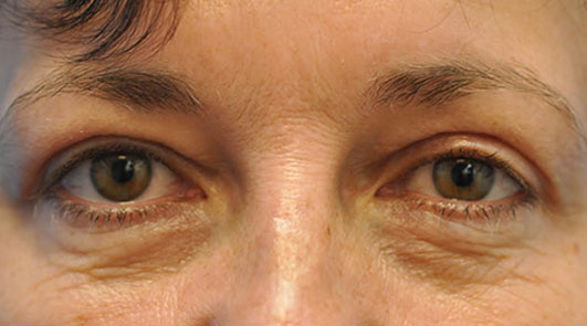 after image