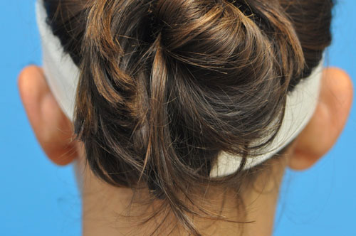 before image