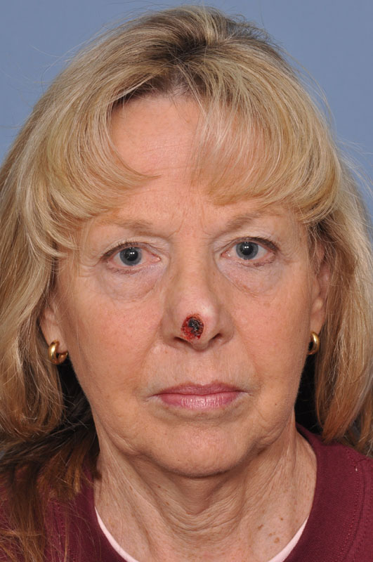 before image