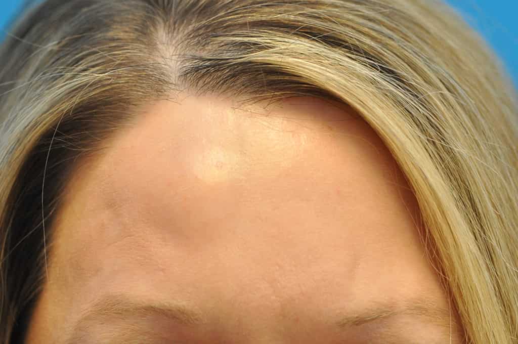 before image