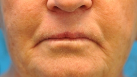 after image